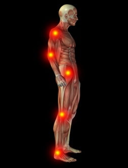 Muscle man with painful areas