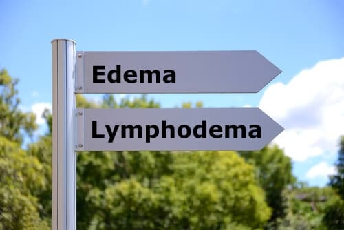 Edema and Lymphodema differences