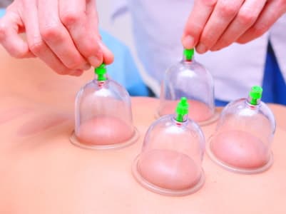Further reading about cupping therapy