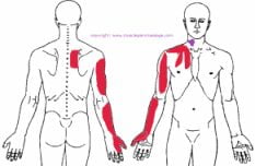 Referred muscular pain from the scalene muscles